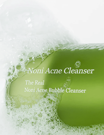 The Real Noni Acne Bubble Cleanser 155ml - 2